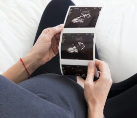 Pregnant woman looking at an ultrasound of her baby to determine the sex with the nub theory.