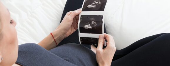 Pregnant woman looking at an ultrasound of her baby to determine the sex with the nub theory.