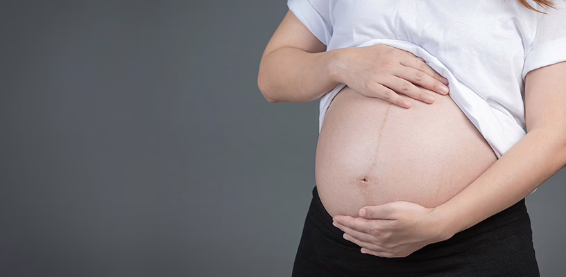 Pregnant woman placing her hands on her belly in anticipation of her water breaking.