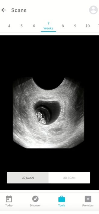 Pregnancy Plus’s library of weekly ultrasounds.