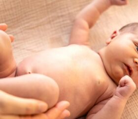 A newborn lying on a blanket with his arms extended after being startled.